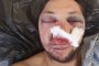 Пребиха зверски опозиционен журналист, полицията спи