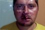   Пребиха с бухалки свидетел срещу Ценко Чоков 