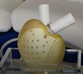 Вечно изкуствено сърце от Франция