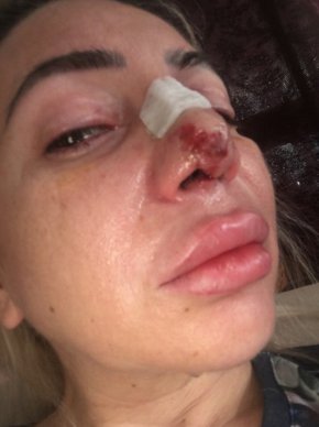Аз бях опитното зайче, лабораторния плъх на двама касапи: Оперирана от фалшив лекар