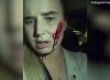  Простреляха веган, спасил зайци от ферма